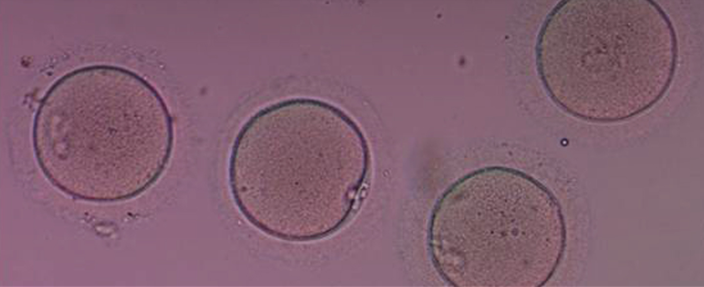 blastocyst transfer oocyte ivf fertilization vitro
